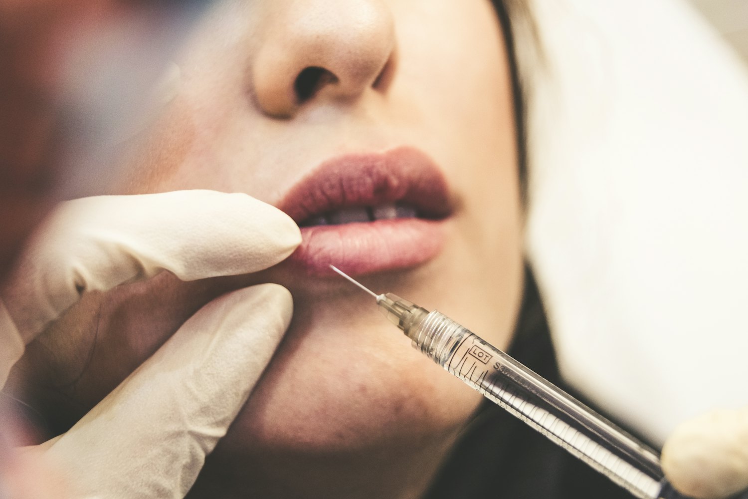 Ablaze Aesthetics treatment